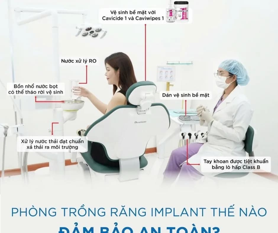 Chăm sóc răng Implant sau khi cấy: làm đúng để dùng được 15–20 năm