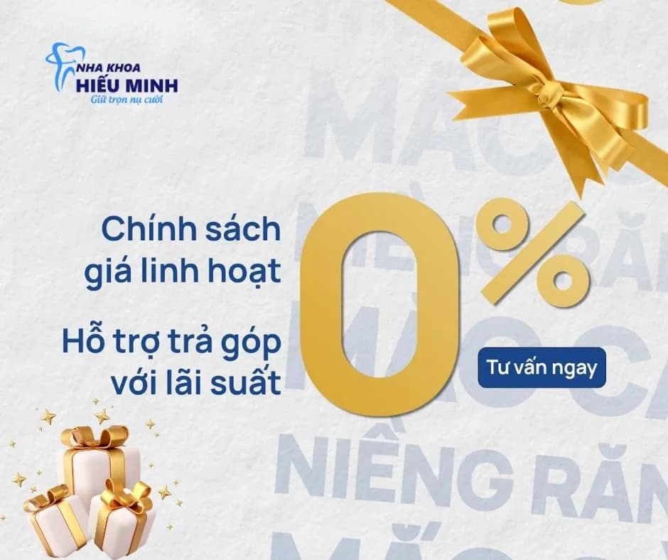 Chi phí niềng răng gồm những khoản nào