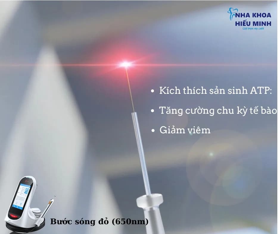 Công nghệ Laser bước sóng đỏ 650nm kích thích lành thương, giảm viêm