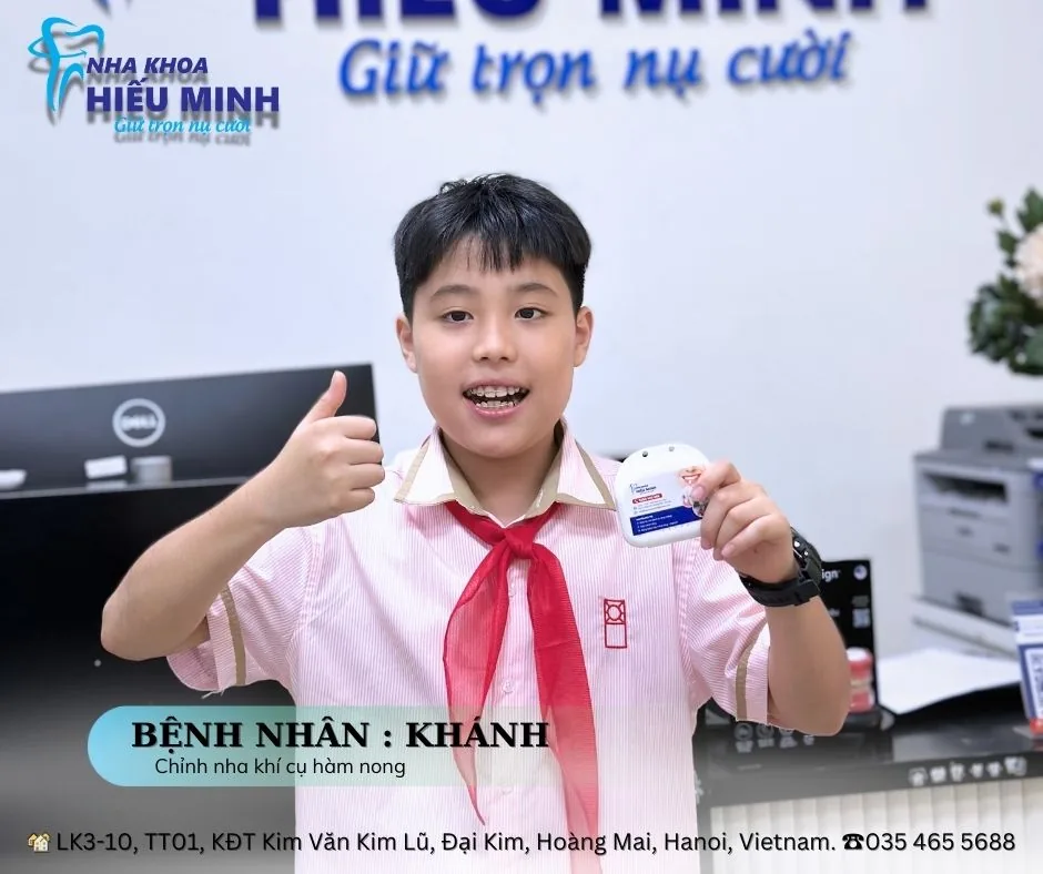 Bệnh nhân Khánh chỉnh nha bằng khí cụ hàm nong tại Nha khoa Hiếu Minh