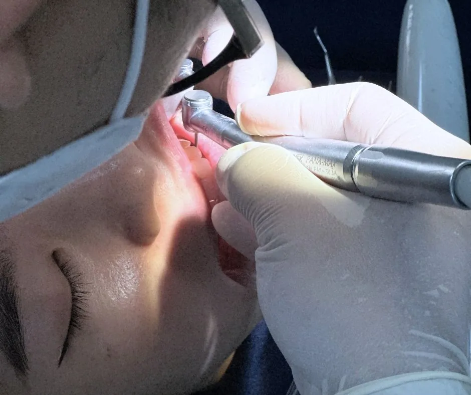 Điều trị nha chu bằng Laser tại Nha khoa Hiếu Minh