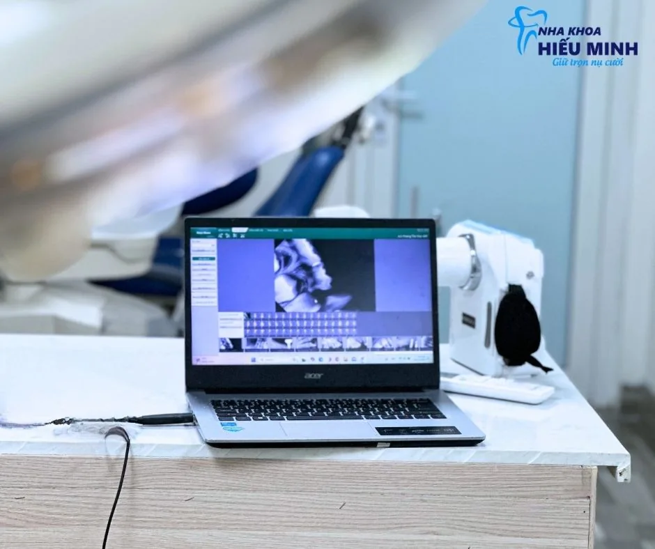 Chẩn đoán hình ảnh răng bằng phần mềm nha khoa số hóa