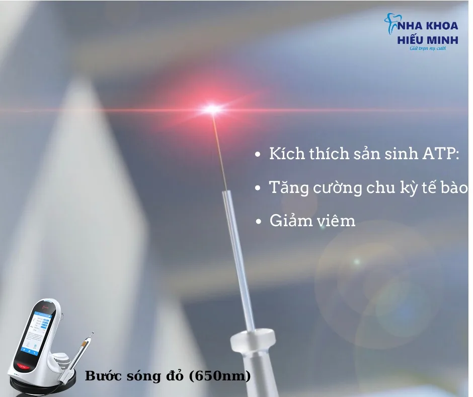 Công nghệ Laser bước sóng đỏ 650nm kích thích lành thương, giảm viêm